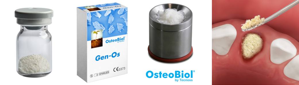 osteobiol