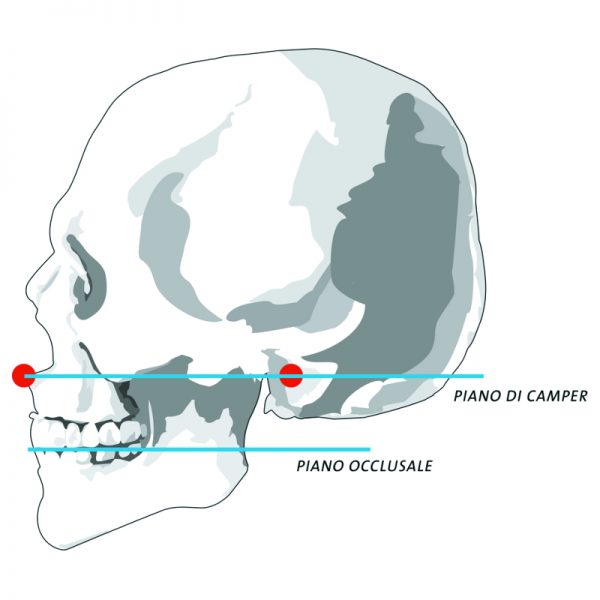 Articolatore CA 3.0 - CANDULOR - immagine 4