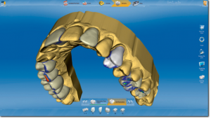 CAD-CAM dentale 2